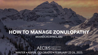 How to Manage Zonulopathy